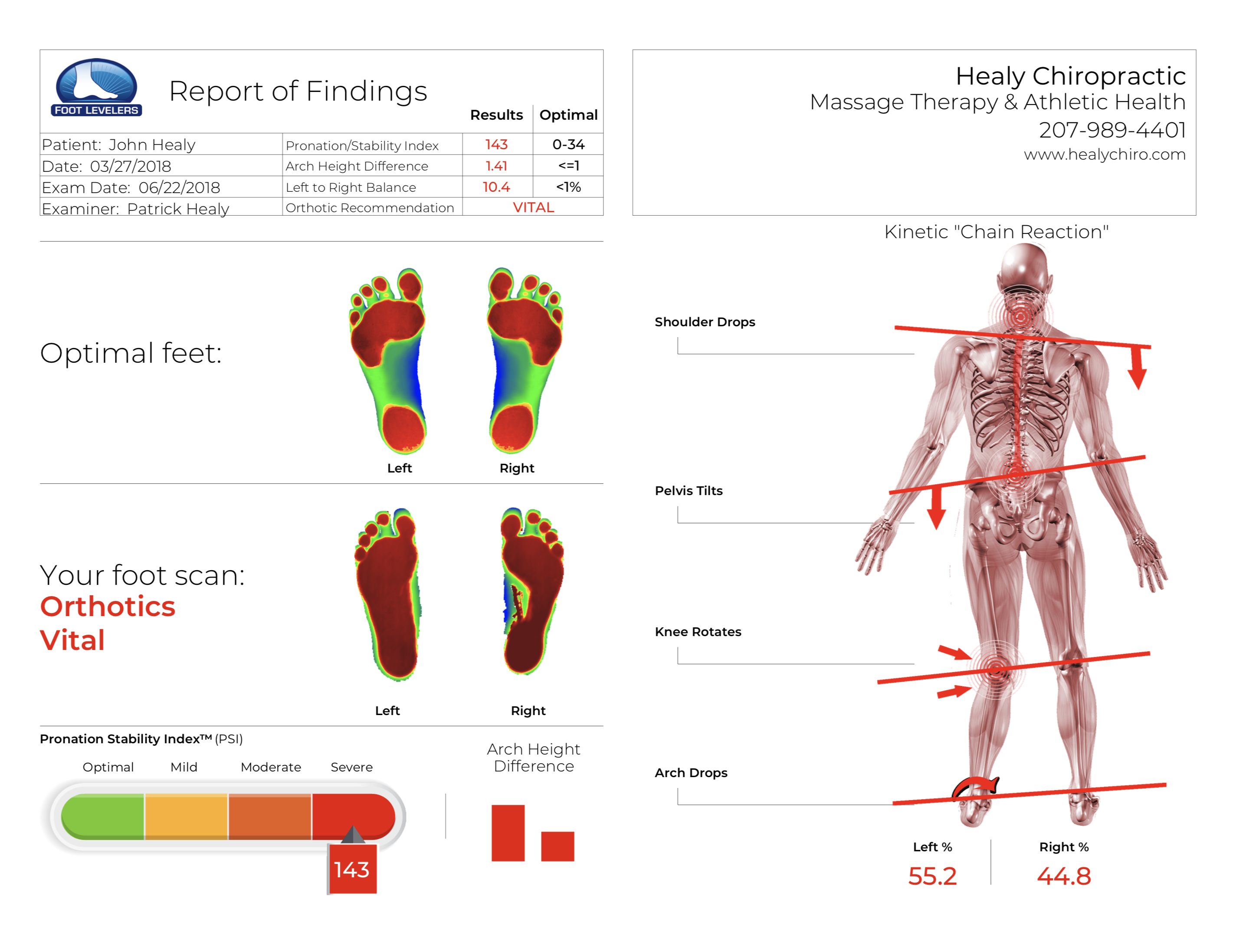 Uneven foot scan flat feet